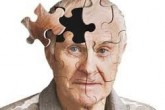13 راهکار برای جلوگیری از ابتلا به آلزایمر