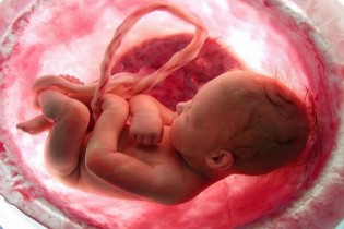 صدور بیش از ۵۰۰ مجوز سقط جنین درمانی در ۶ ماهه نخست امسال
