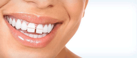 بهترین روش بستن فاصله میان دندان‌ها