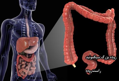 نشانه‌های سرطان گوارش را بشناسید