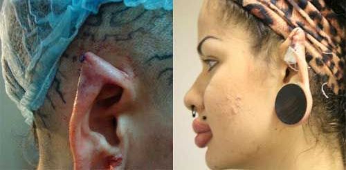 جراحی های عجیب و غریب زیبایی در خانم های ایرانی