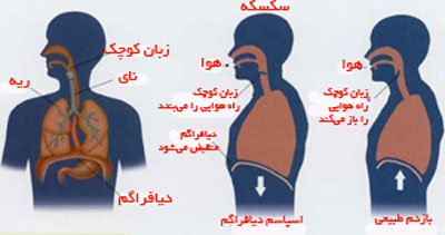 وقتی سکسکه قاتل می‌شود!